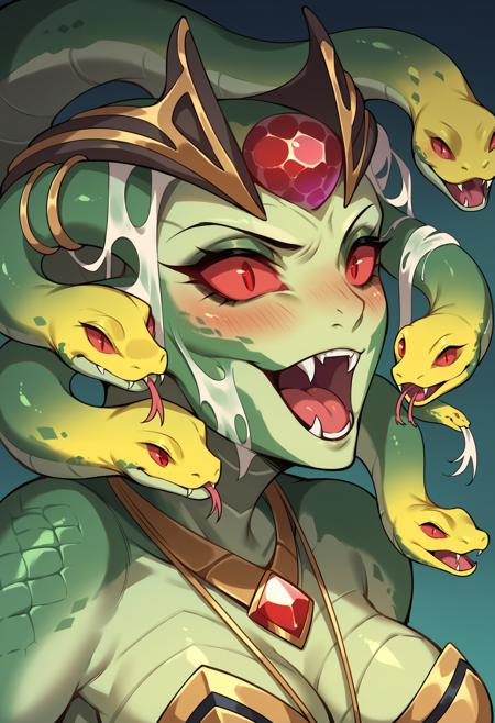 Medusa - Dota 2 [SDXL Pony]