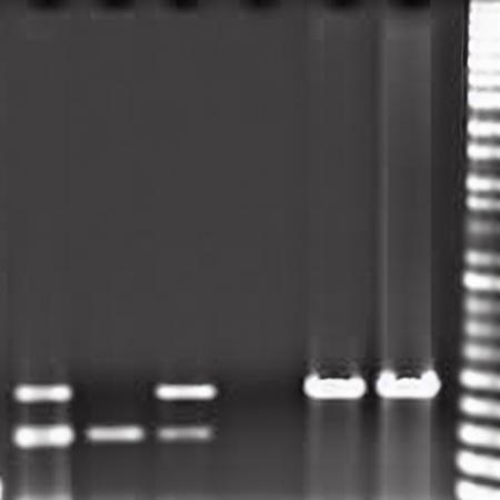 Electrophoresis-V1