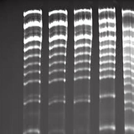 Electrophoresis-V1
