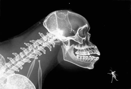 X-Ray