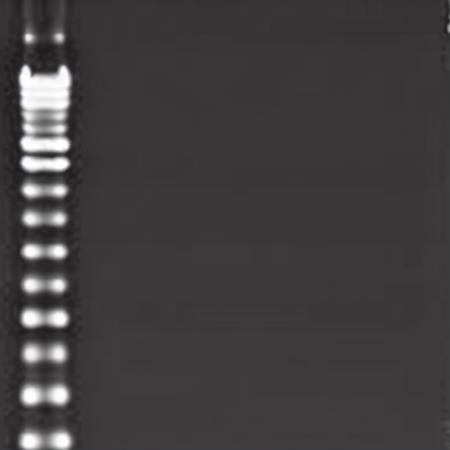 Electrophoresis-V1