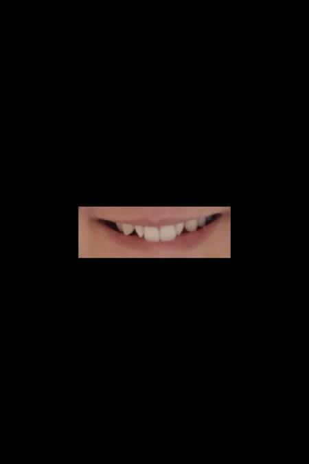 fangs vampire teeth | 尖牙